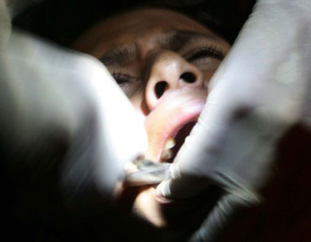 Photo of Dentist Pulling Out Teeth